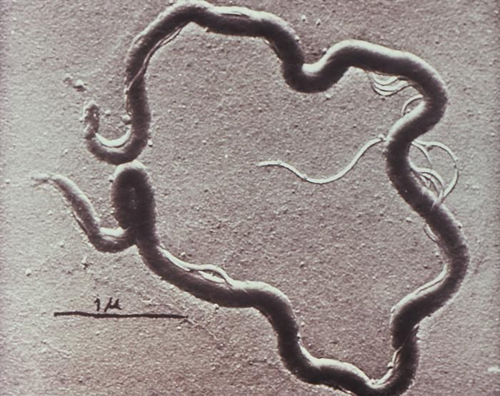 Syphilis 'not A Disease Of The Past': STD Has Been On The Rise In South ...