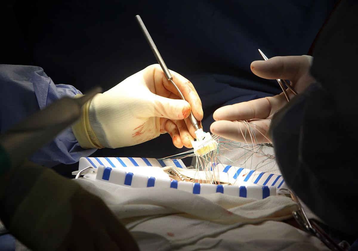 Heart Surgery