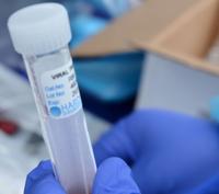 S.C. DHEC, Augusta University Health play blame game on delayed reporting of COVID-19 test results