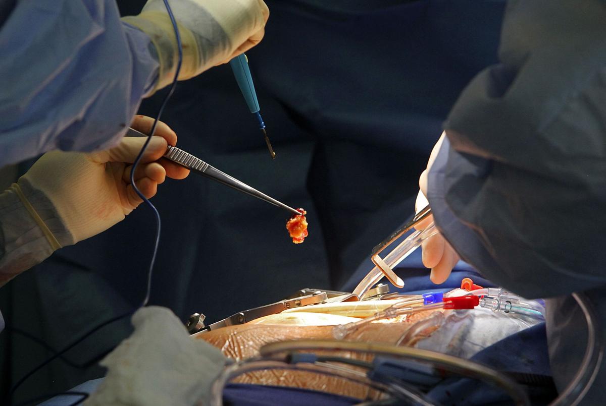 Heart Surgery