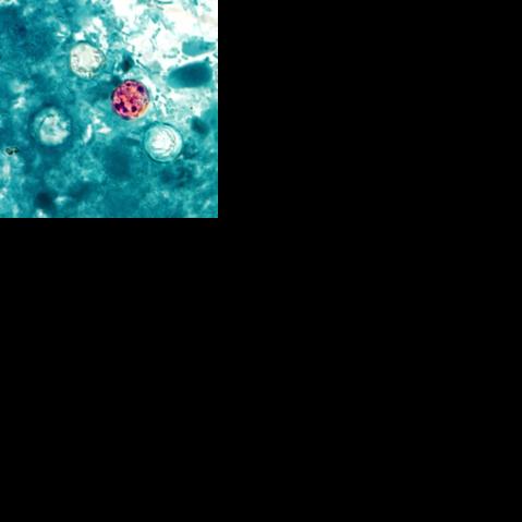 Cyclosporiasis is in South Carolina, though illnesses not tied to nationwide outbreak