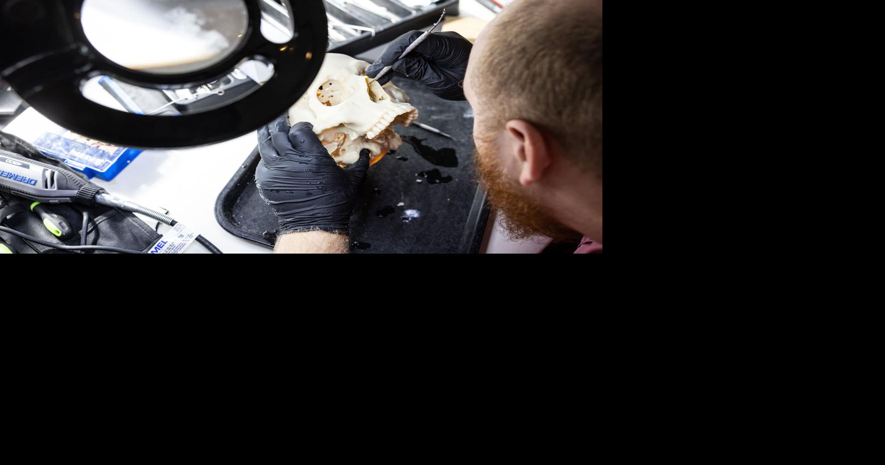 Dallas implant designer channels artistic talent to repair mangled skulls and jaws