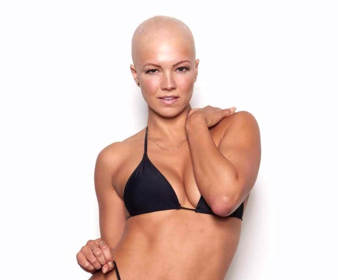 Sports Illustrated model, Penn State alumna doesn't let hair loss