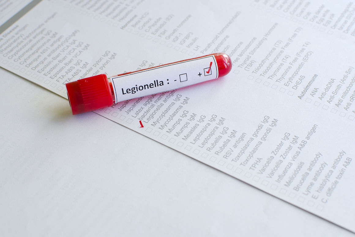The summer risk of Legionnaires' disease