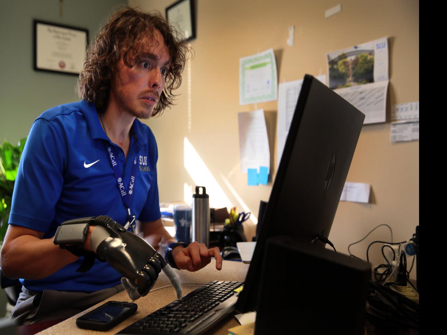 Chimp Attack Survivor Starts New Trauma Care Program Life Qconline Com