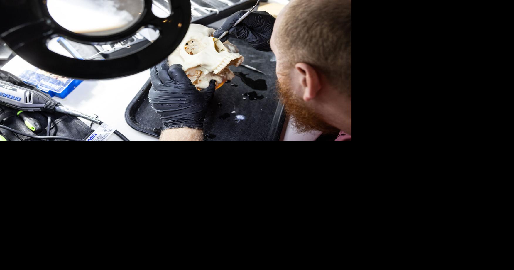 Dallas implant designer channels artistic talent to repair mangled skulls and jaws Cheryl Hall The Dallas Morning News Jan 3, 2026 16 mins ago
