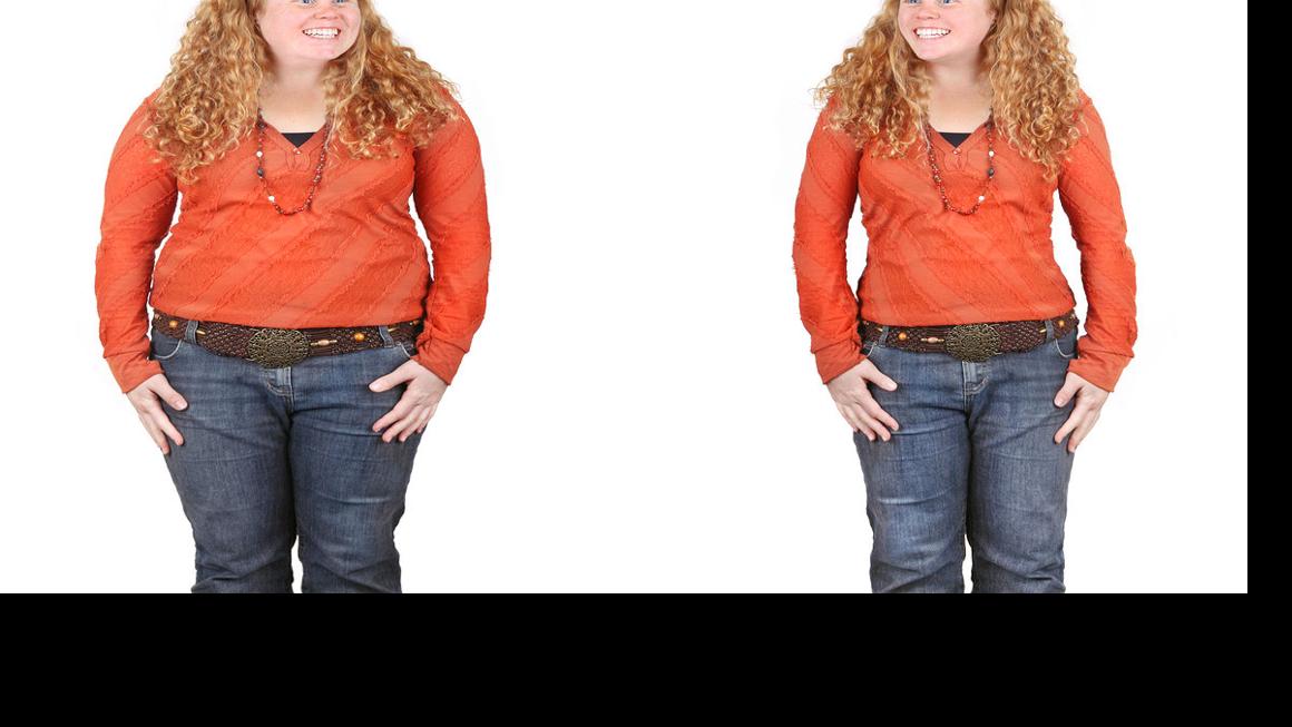 First comes weight loss, then extra skin Life