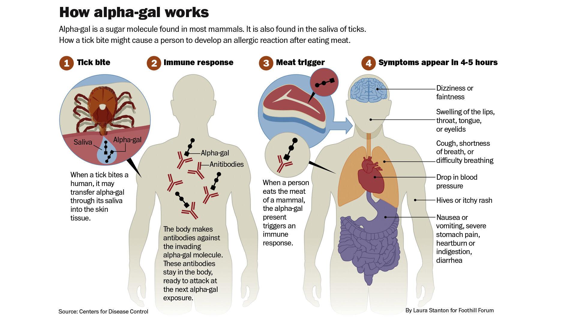 Alpha Gal Syndrome The Link Between Ticks And Red Meat Allergy Foothills Forum 5844