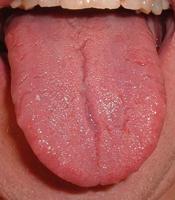 She Blinded Me with Science: What hurts when your tongue is irritated?