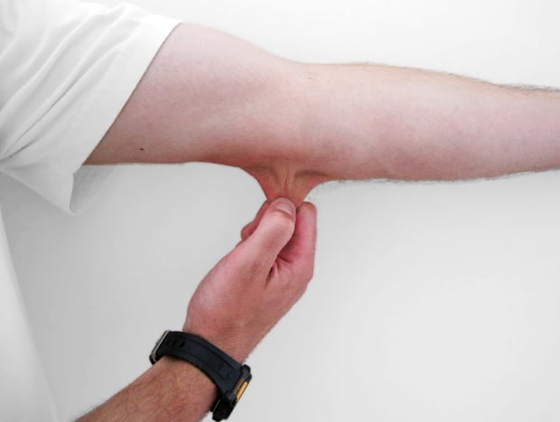 Why Doesn T It Hurt to Pinch Your Elbow?
