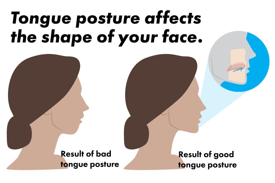 Opinion If You Care About Your Face Care About Tongue Posture
