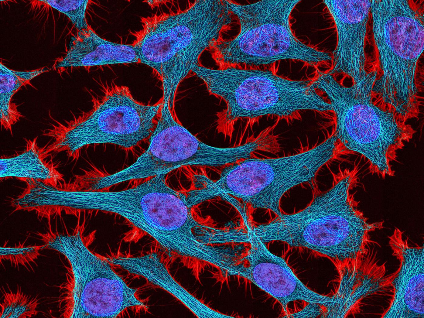 Could The Henrietta Lacks Case Happen Today Food Reformer