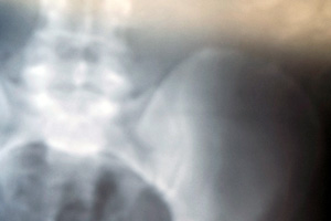 Ask the Pros: xray