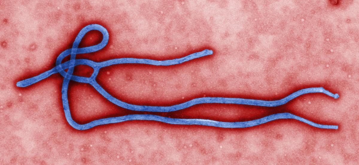 the state of ebola hemorrhagic fever in the world today Thomas eric duncan and the ebola crisis in west africa and the united states thomas eric duncan at a party in monrovia, liberia, 2011 image ownership: public. the state of ebola hemorrhagic fever in the world today Thomas eric duncan and the ebola crisis in west africa and the united states thomas eric duncan at a party in monrovia, liberia, 2011 image ownership: public.