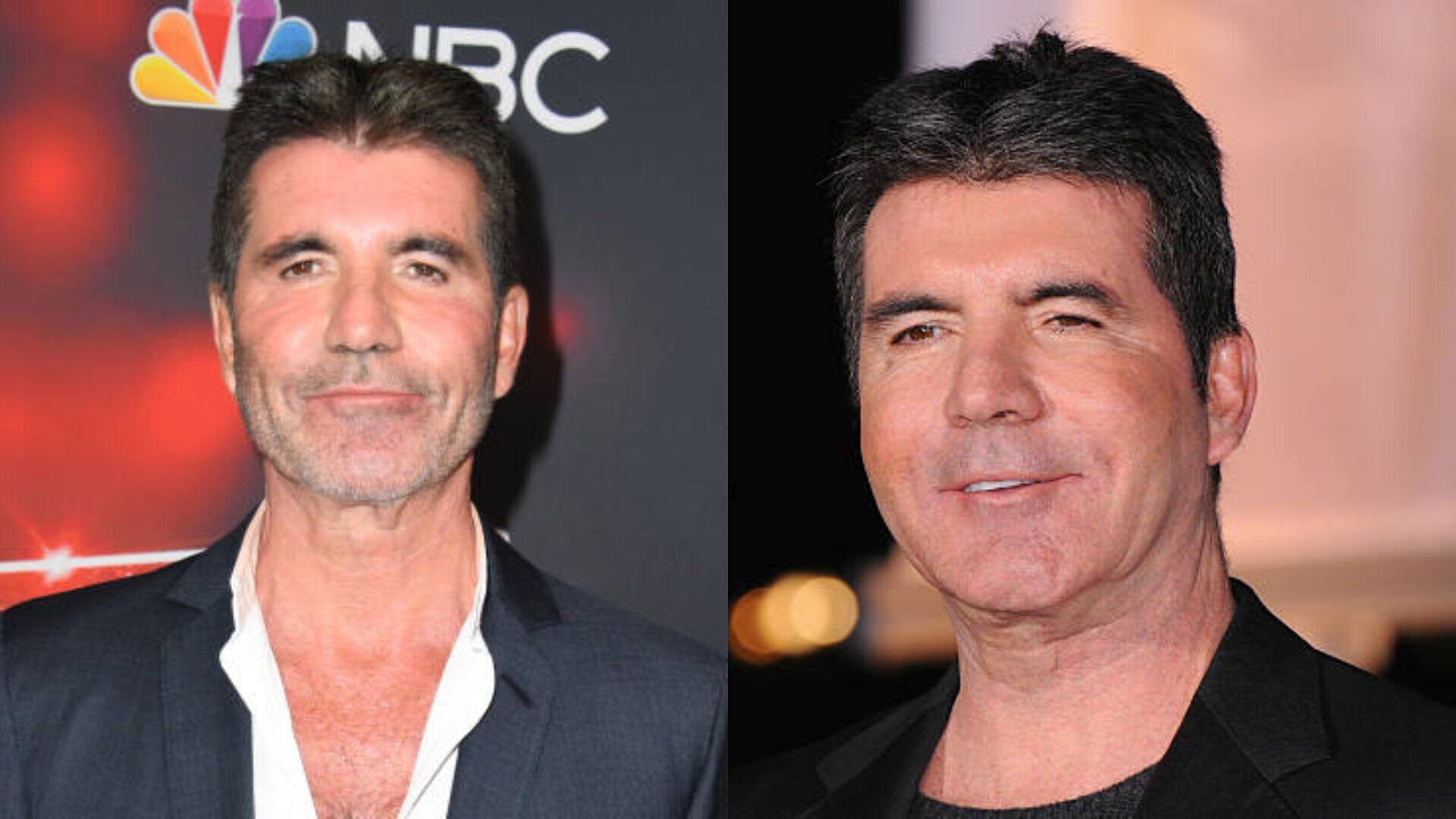 Simon Cowell removes face filler after admitting he went 'too far'
