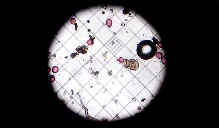 It's not in your head This has been a rough pollen season for Richmond