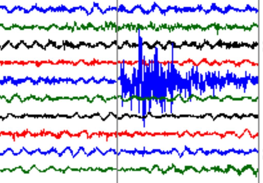 2.8 Magnitude Earthquake Shakes Richmond Area Sparks Community Reaction