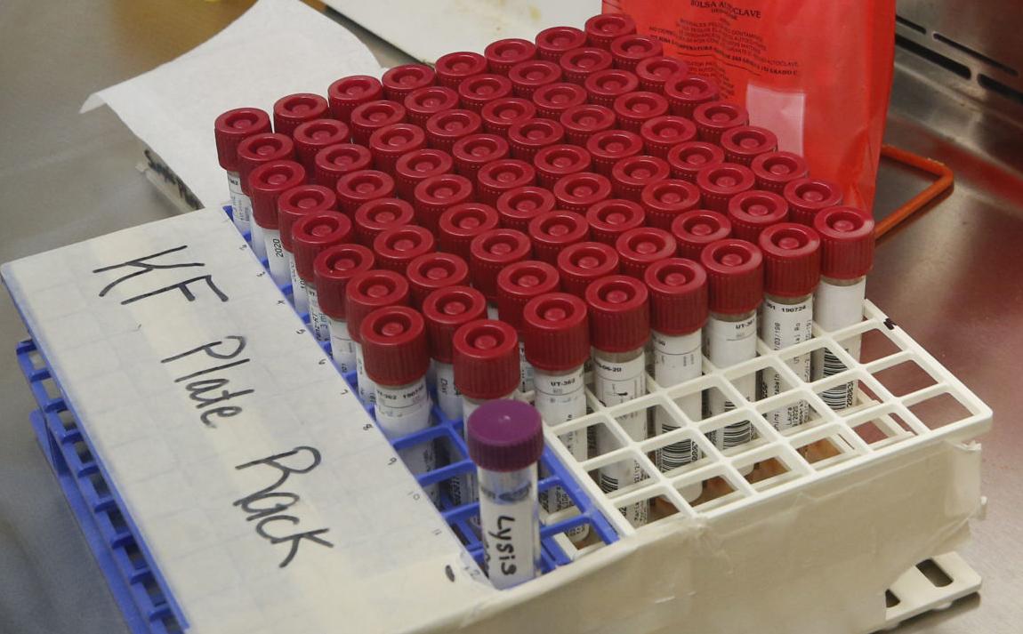 Henricobased Laboratories offering COVID19 antibody tests
