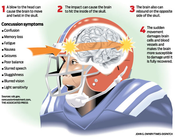 Junior Seau Suffered Chronic Brain Damage, NIH Study Finds