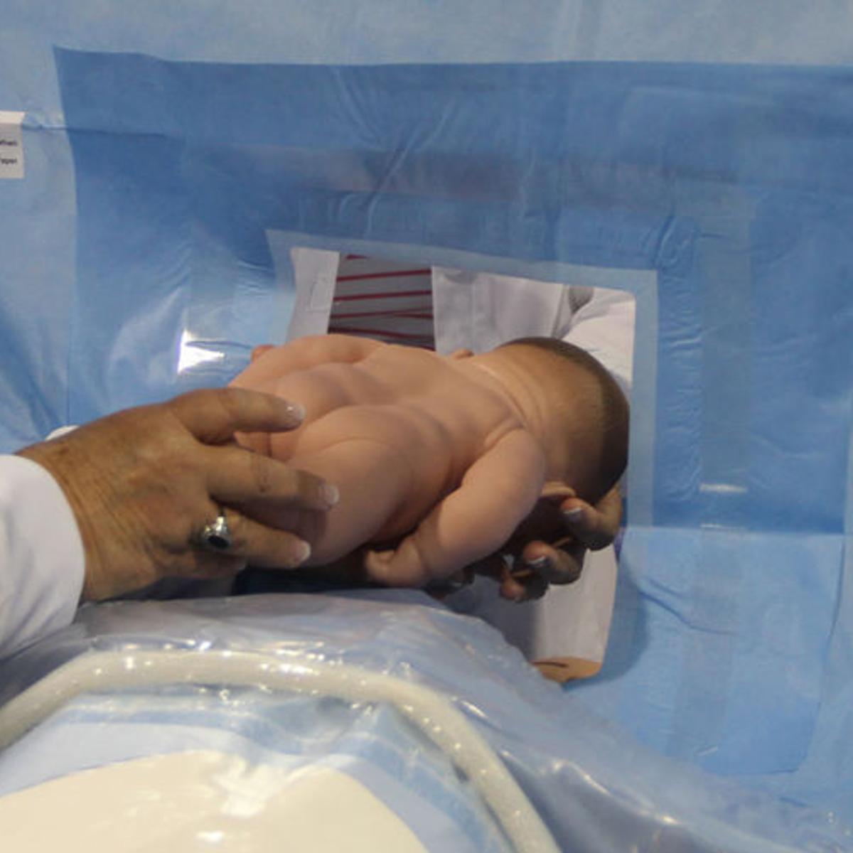 Nurses Invent Drape That Allows Mom Baby Contact During C Section Nurses Invent Drape That Allows Mom Baby Contact During C Section