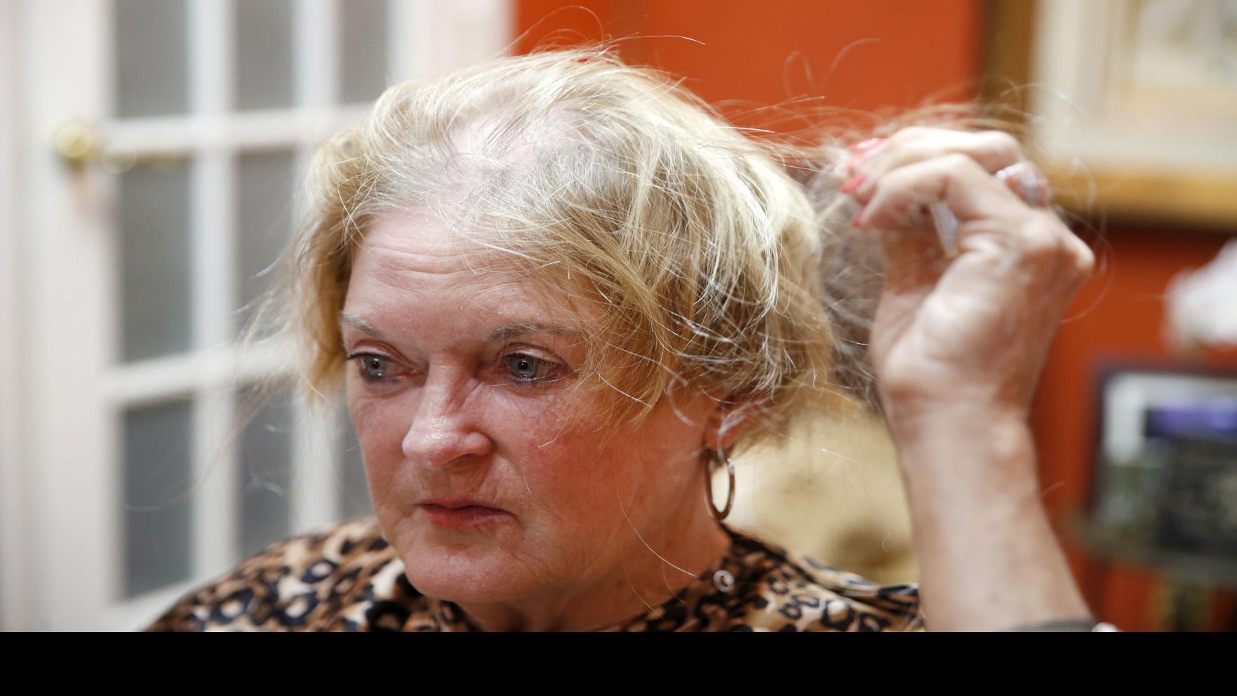 Looking At Reality As Carole Johnson S Chemotherapy Continues She Copes With Losing Her Hair Richmond Com