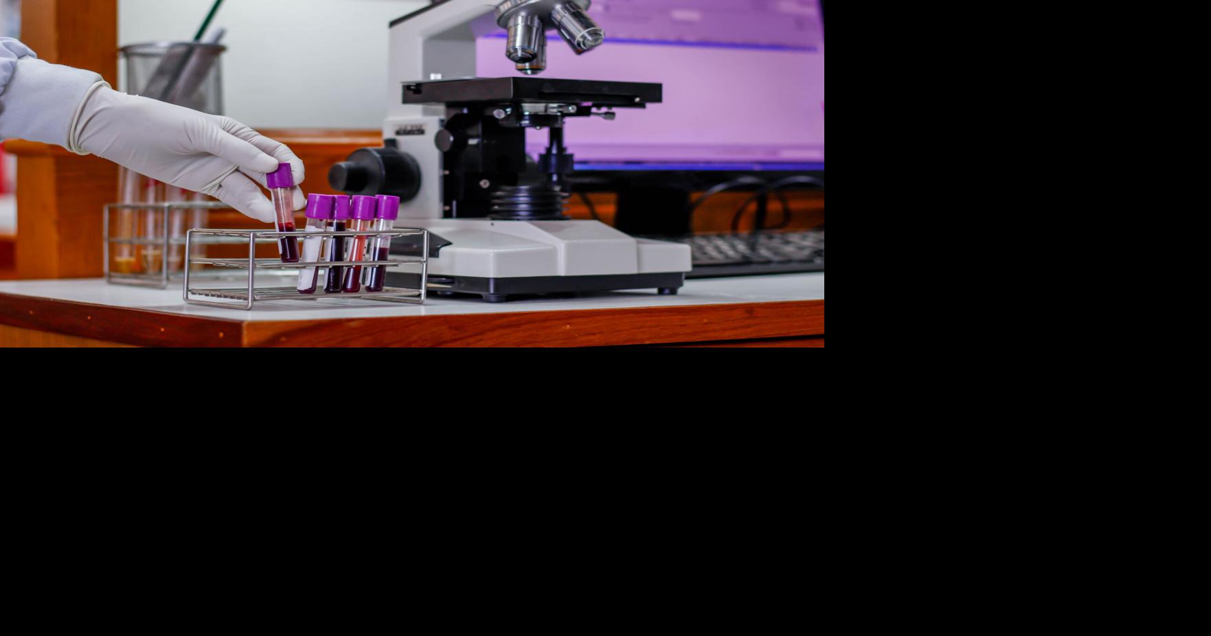 Supply shortages hamper RRH testing: Hospital working on alternative ...