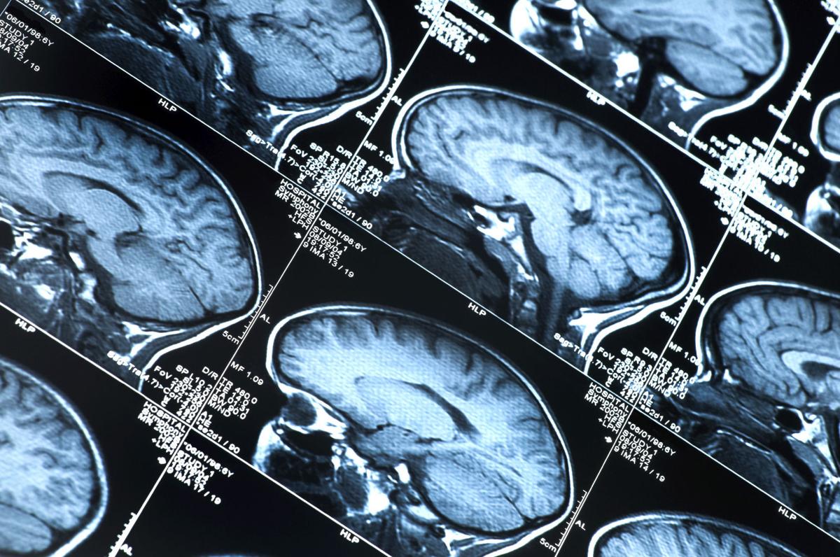 the use of brain scans for evidence of blood flow patterns related to mental illness (because of a mental illness or disability) changes in blood flow are taken to indicate brain activity india's novel use of brain scans in courts is. the use of brain scans for evidence of blood flow patterns related to mental illness (because of a mental illness or disability) changes in blood flow are taken to indicate brain activity india's novel use of brain scans in courts is.
