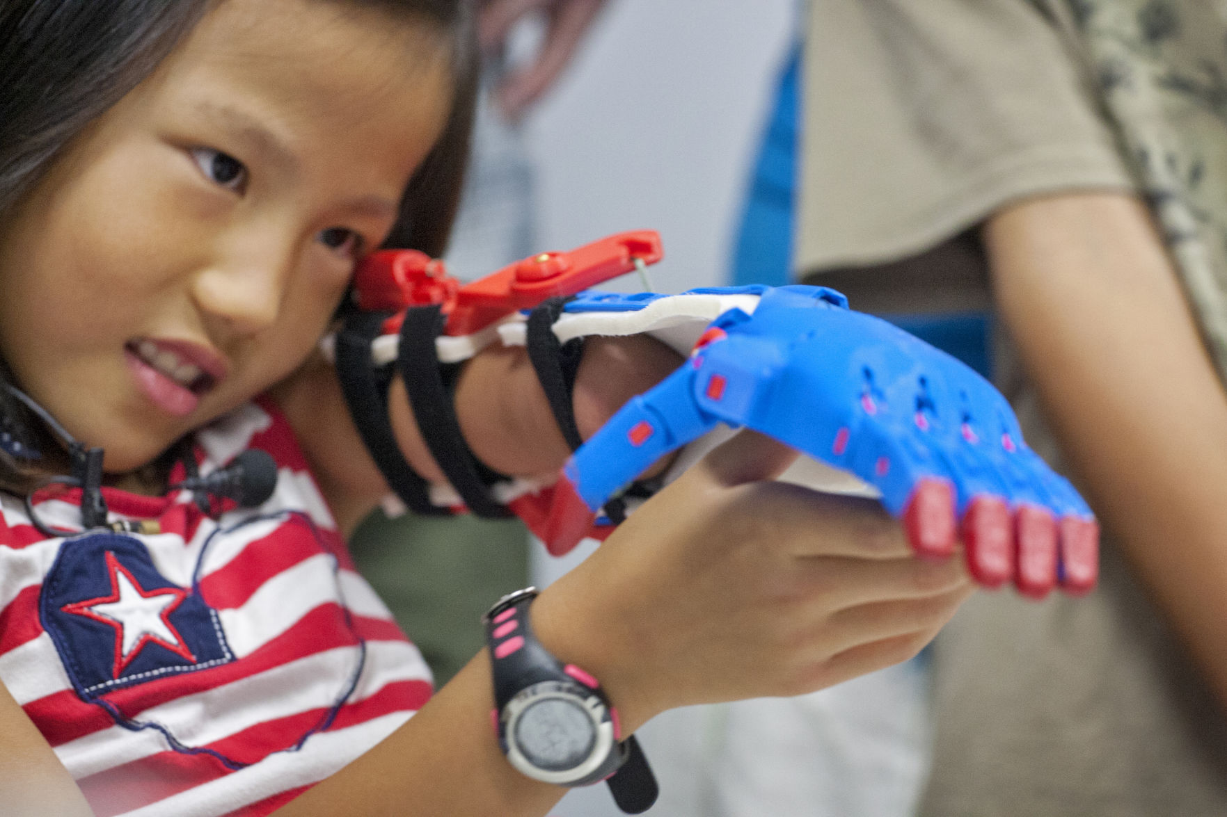 Technical Institute Engineers Free Prosthetics For Kids Using 3-D Printer