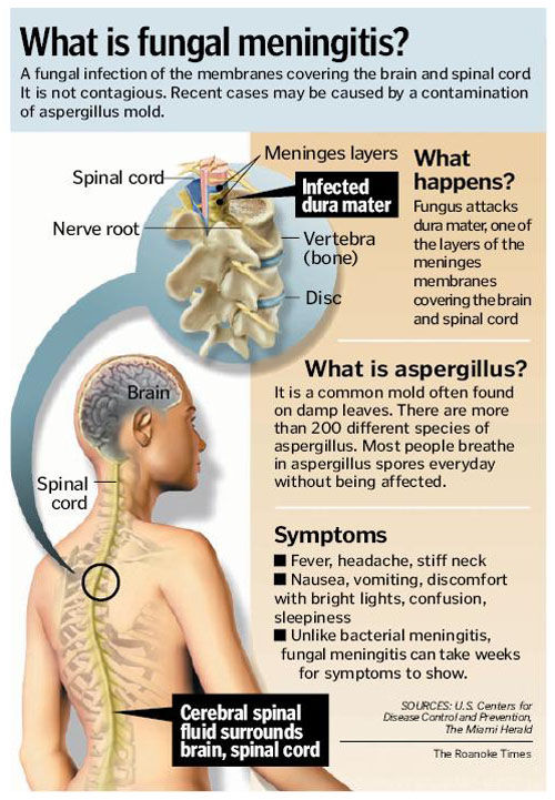 Roanoke Clinic Used Drug Tied To Meningitis Outbreak Archive Roanoke Com