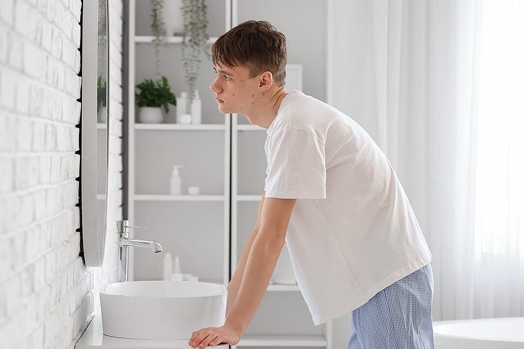 7 proven acne treatments for teens