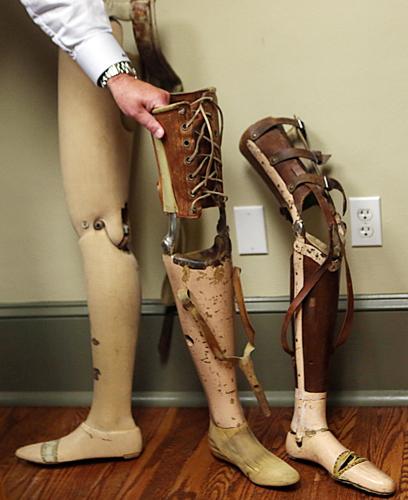 Why People Abandon High-Tech Prosthetics, Innovation