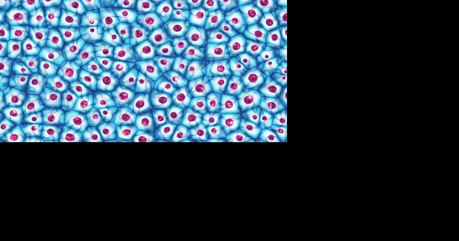 A new tool to find hidden ‘zombie cells’ | Feature Story ...