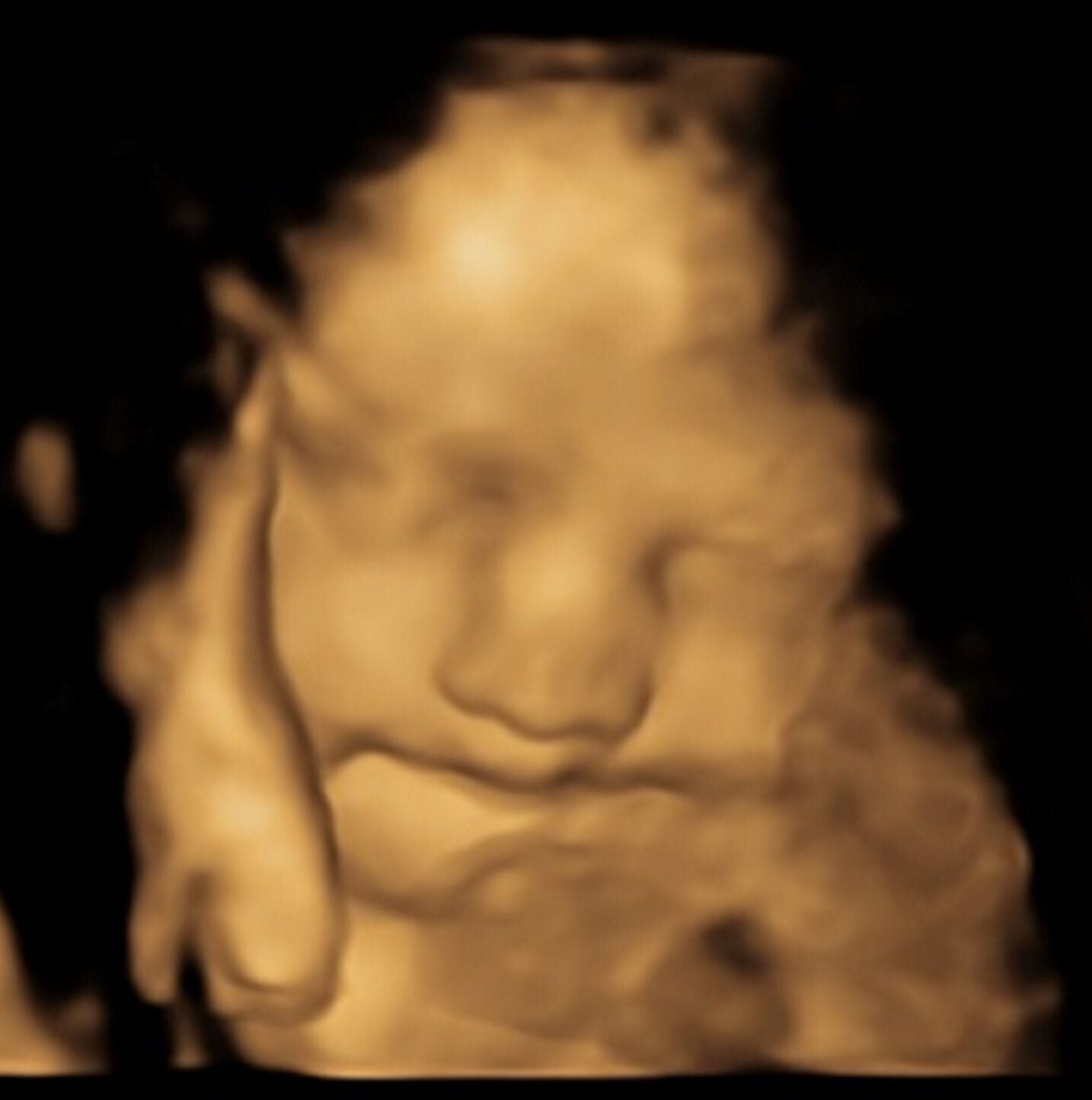 Toddlers can remember smells from the womb | News | sanfordherald.com