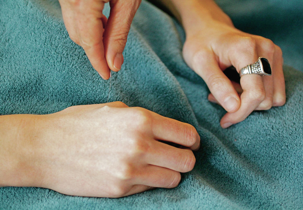 Acupuncture business plan pdf picture