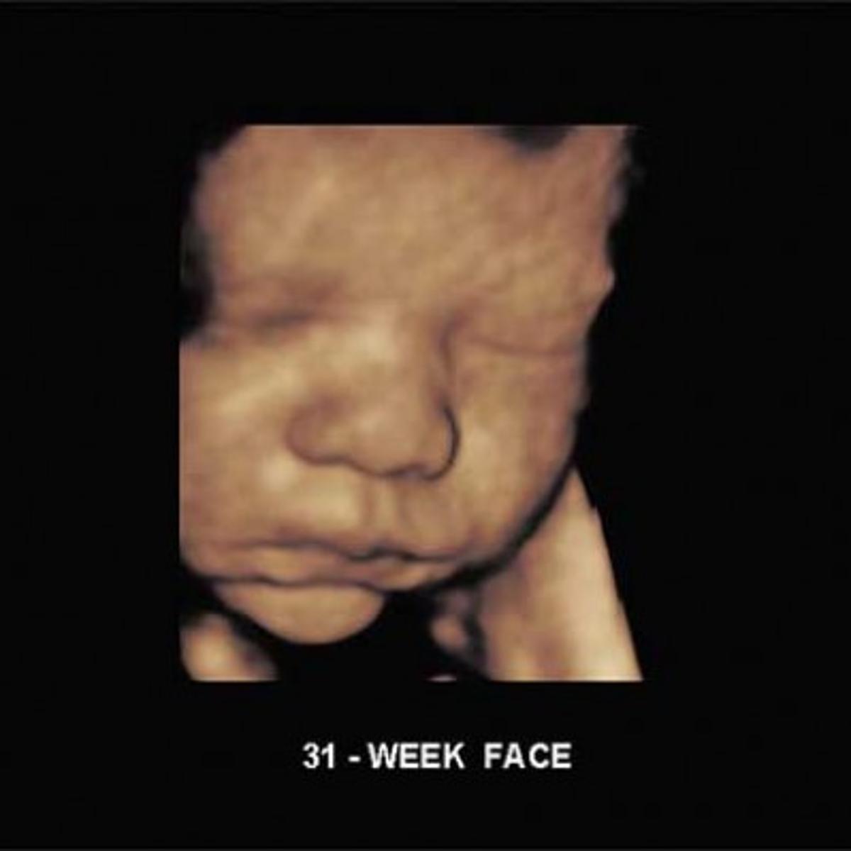 3d 4d Ultrasound Technology Comes Ton Cheraw Practice Lifestyles Scnow Com