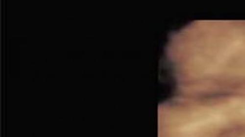 3d 4d Ultrasound Technology Comes Ton Cheraw Practice Lifestyles Scnow Com