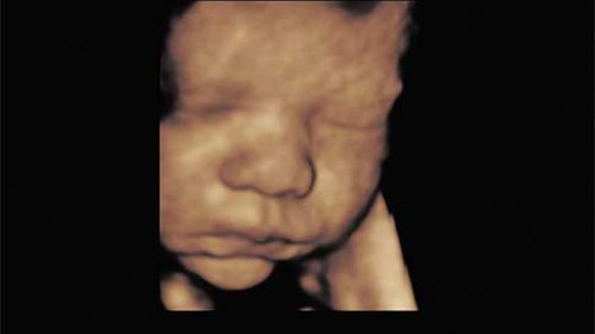 3d 4d Ultrasound Technology Comes Ton Cheraw Practice Lifestyles Scnow Com