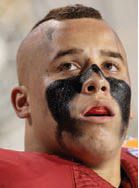 Stanford's Skov out for season