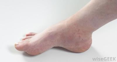 Foot