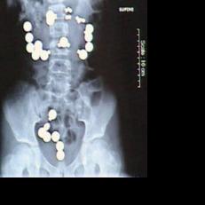 Picture this: Bizarre X-rays you can't make up | Sponsored Content ...