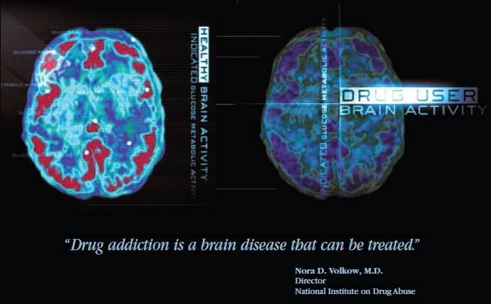 Drug User Brain Activity
