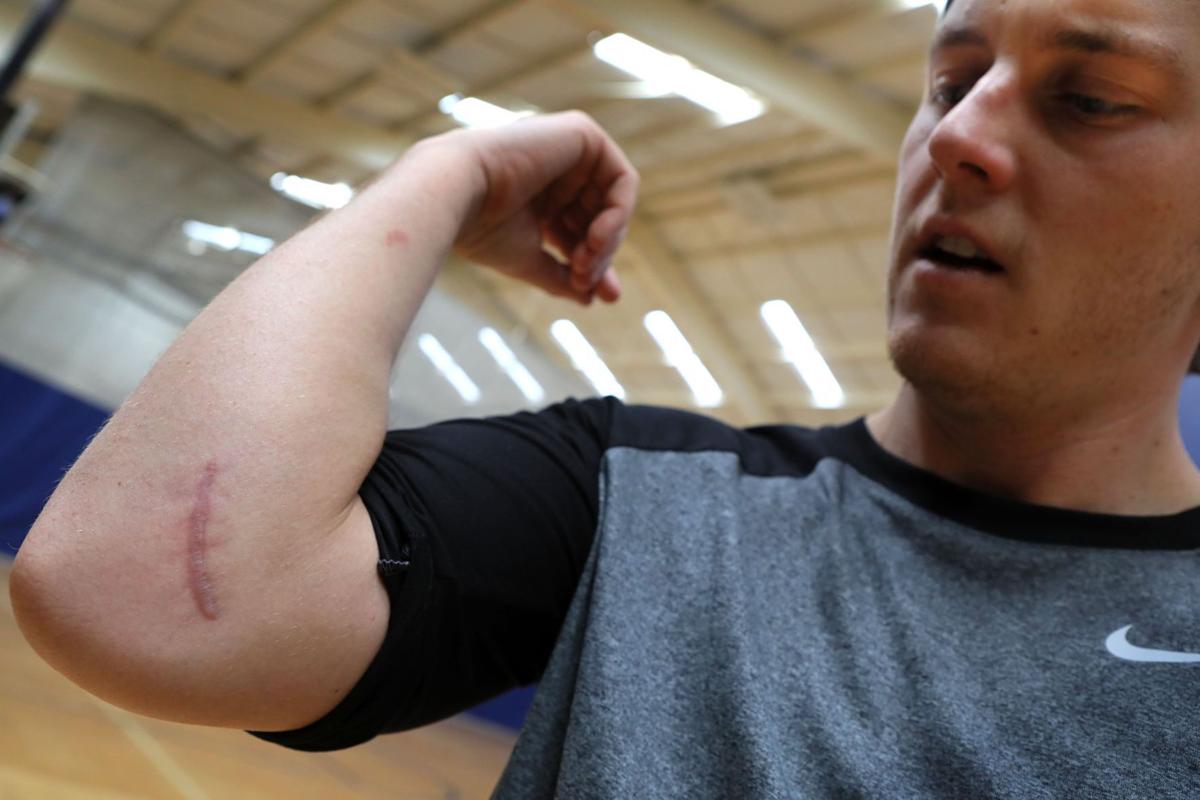 Seth Maness rehabbing elbow