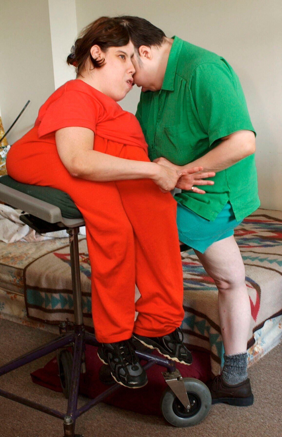 Oldest living conjoined twins die at 62