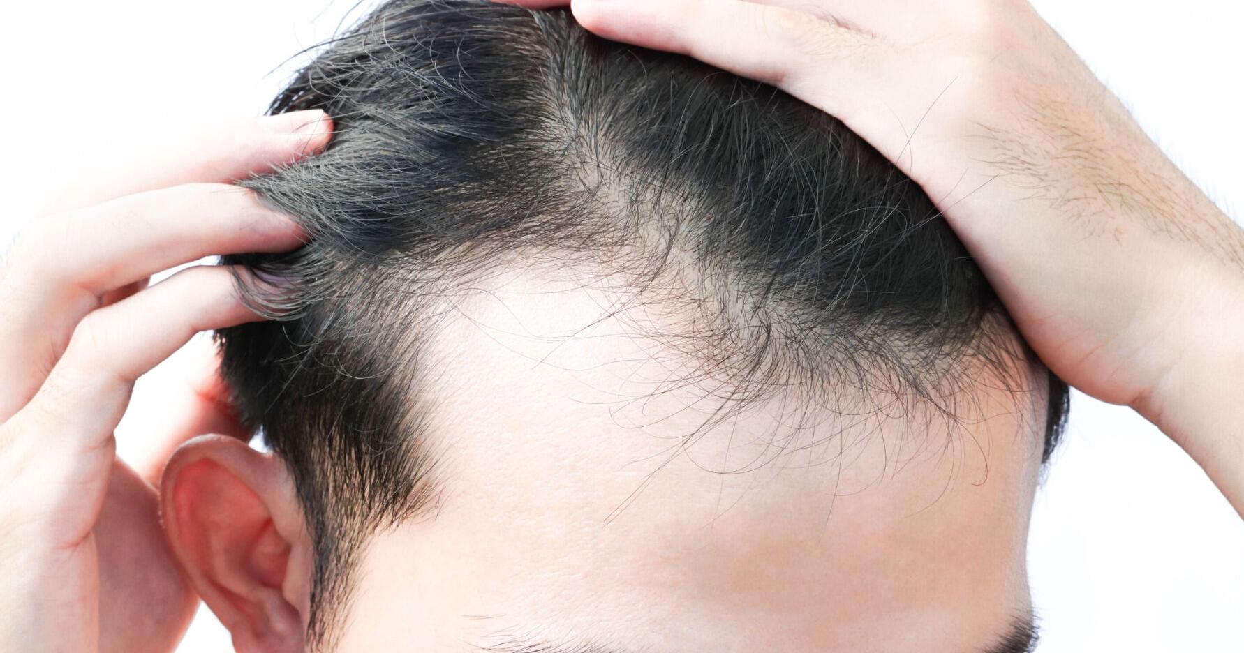 18 best shampoos for hair growth - Vimarsana News