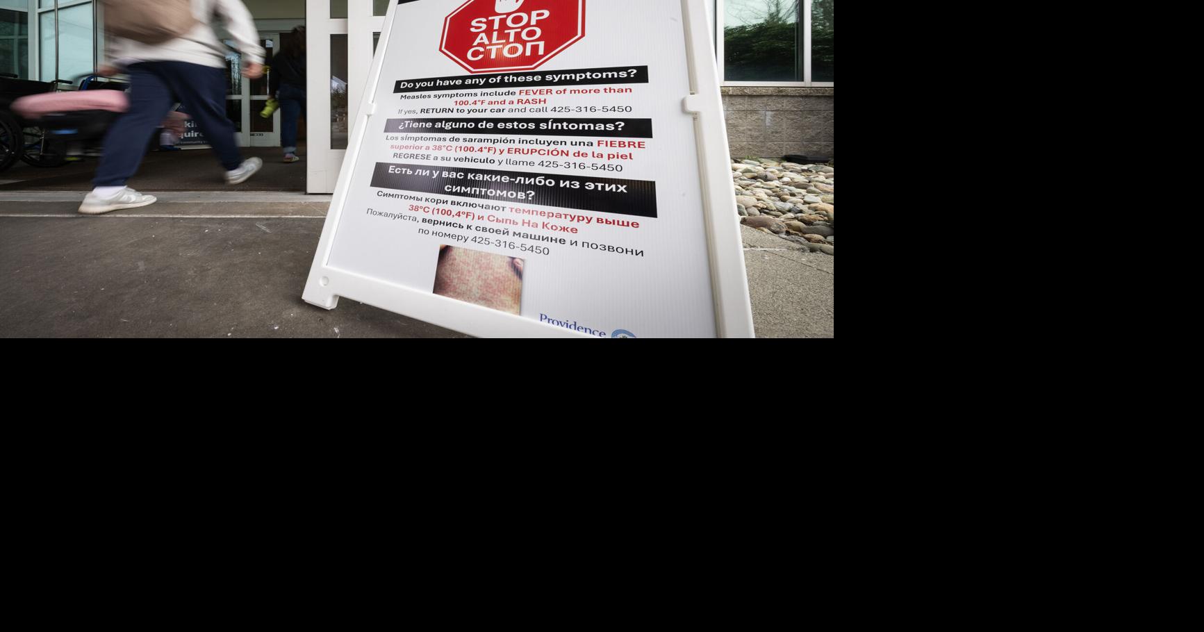 St. Louis County reports first measles case in 20 years