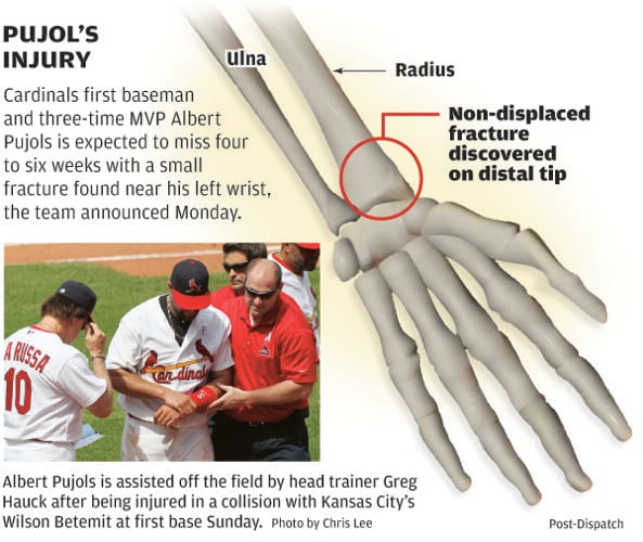 Pujols' injury another obstacle to overcome