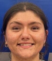 Jordan Speiser, Lutheran St. Charles