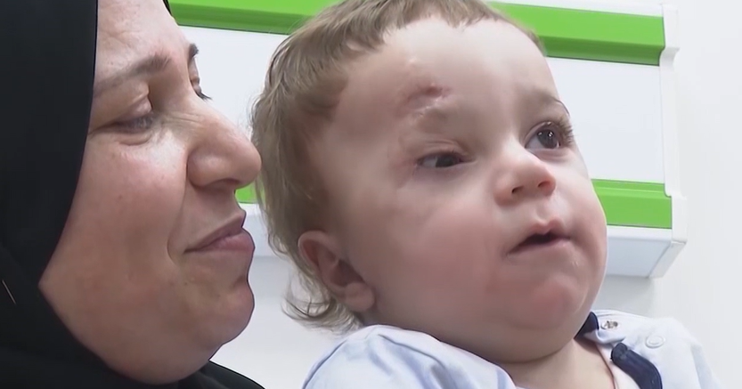A baby evacuated from Gaza lost an eye and most of his family in the war