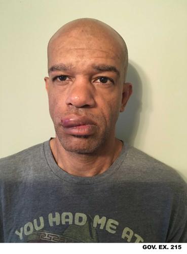 Luther Hall's injuries