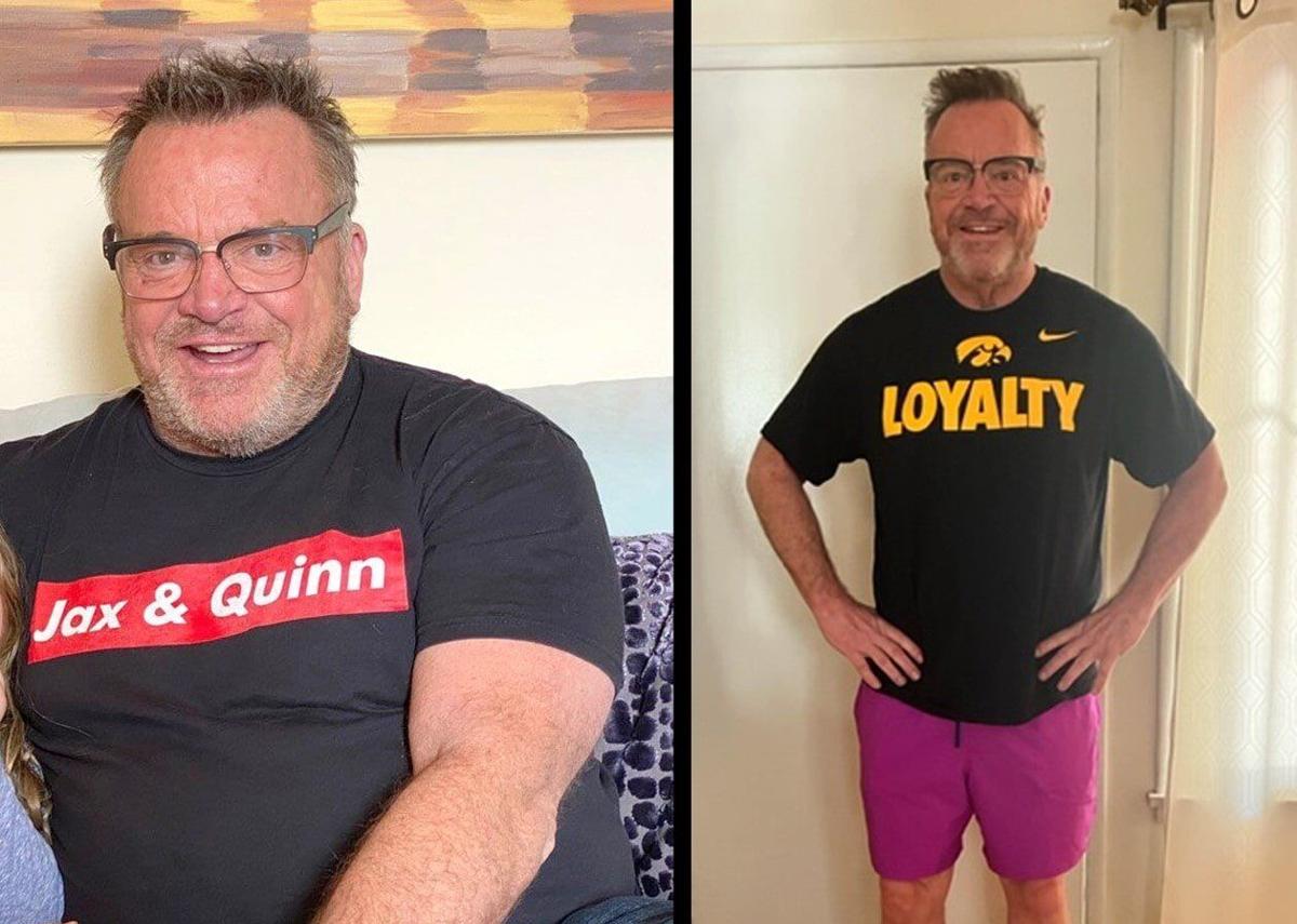 Tom Arnold before and after